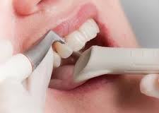 dentist performing procedure on teeth